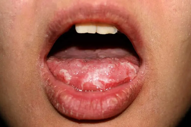 La lengua puede revelar tu estado emocional y tu salud