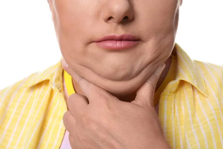 6 tips imprescindibles para reducir la papada