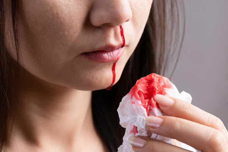 ¿Te sangra la nariz a menudo? ¡Descubre por qué puede ser!