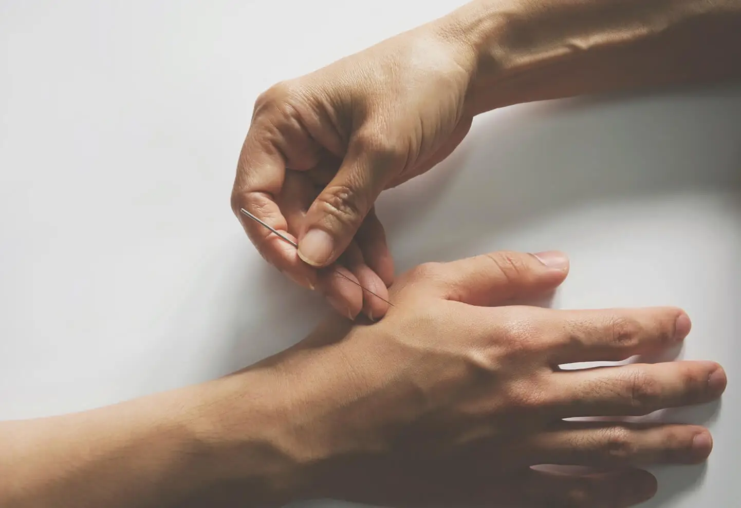 Persona en sesión de acupuntura para el dolor neuropático