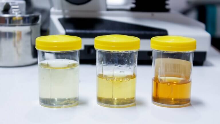 9 tipos de orina que podrían decir algo importante sobre la salud