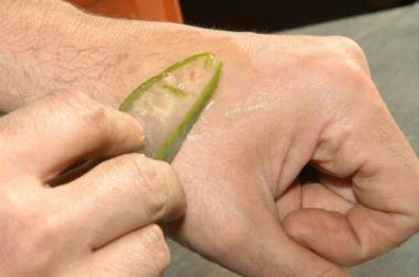 Cubitos de aloe y rosa mosqueta para quemaduras