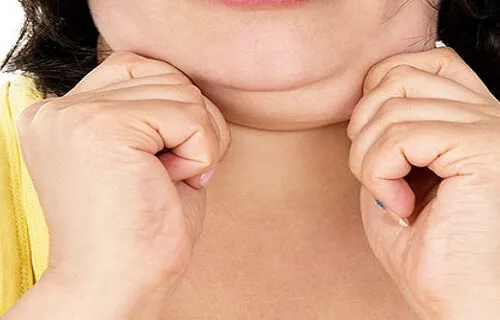 3 formas de disminuir la papada y tonificar el cuello