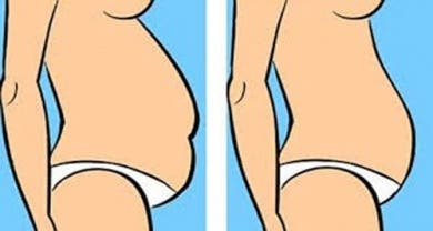 ¿Qué tipo de barriga tienes y cómo reducirla?