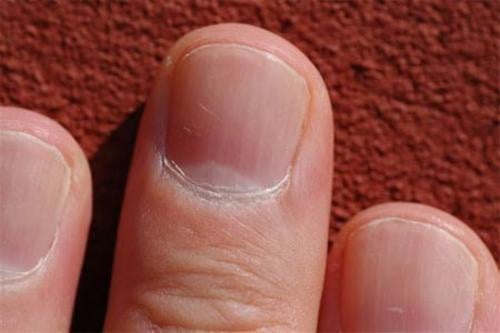 Sabías que el estado de tus uñas puede decir mucho sobre tu salud? - Mejor  con Salud