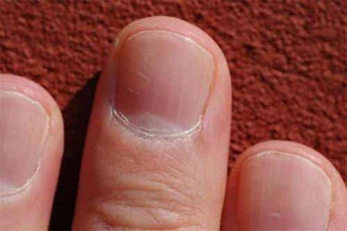 ¿Sabías que el estado de tus uñas puede decir mucho sobre tu salud?