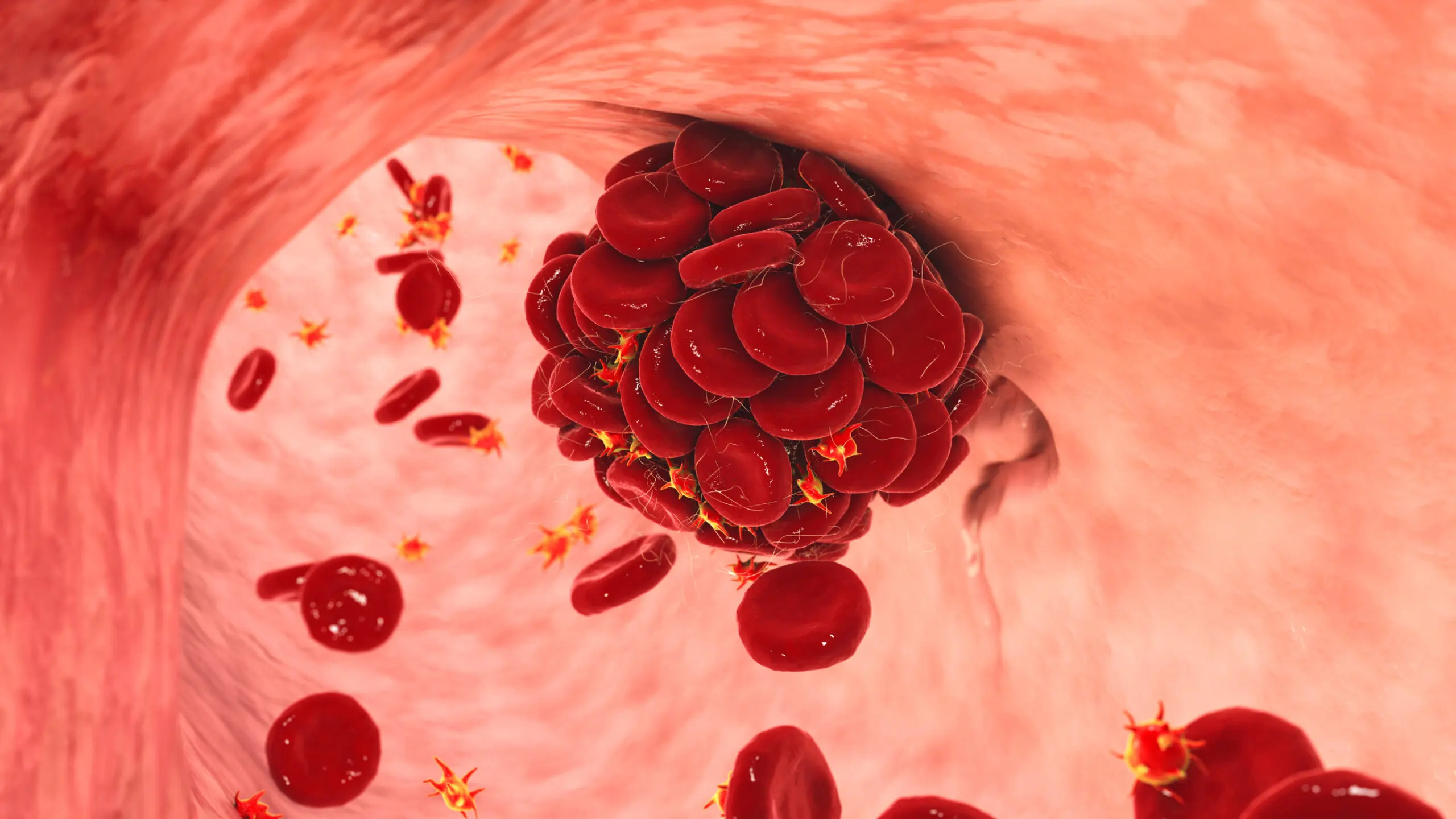 Problemas en la coagulación de la sangre.