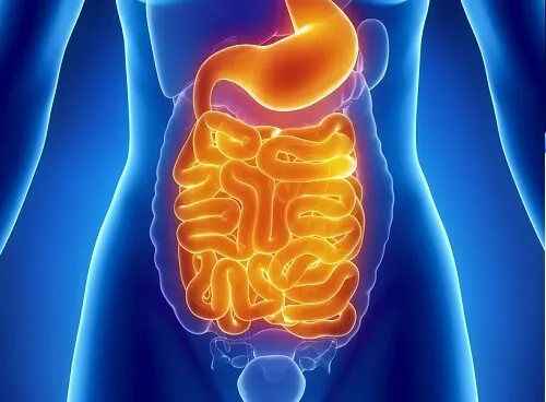 Obstrucción del intestino.