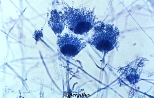 moho Aspergillus