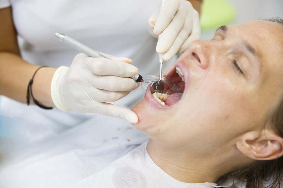 ¿Qué es una amalgama dental?