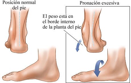 Hábitos que dañan tu talón: ¡No más pasos en falso y con dolor!