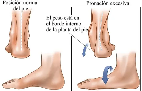 Hábitos que dañan tu talón: ¡No más pasos en falso y con dolor!