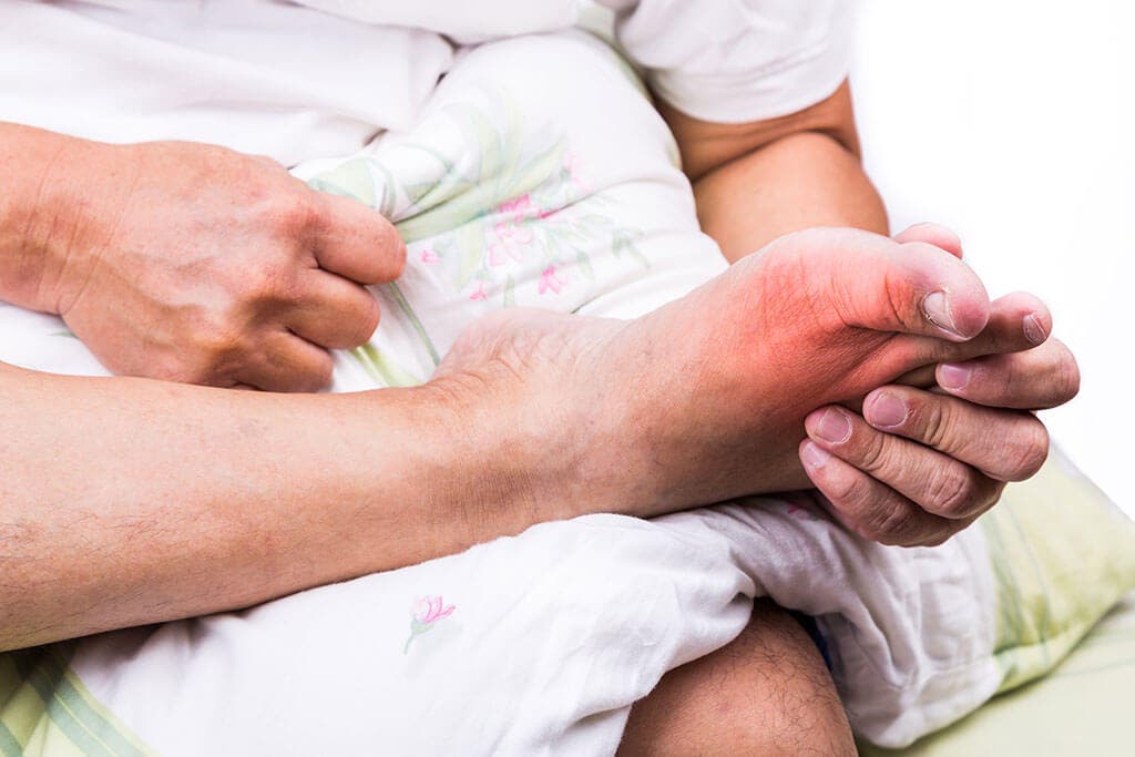 Rimedi per l'acido urico.