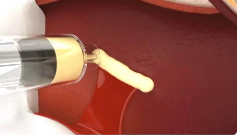 vetigel para detener los sangrados