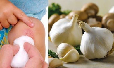 Los 8 mejores antisépticos naturales para tu piel
