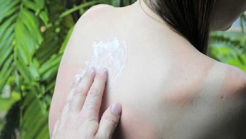 5 consejos para evitar que el sol te queme y manche la piel