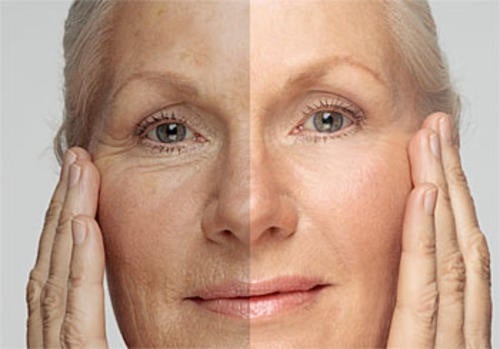 ¿Cuántos años tiene tu piel? Aprende a "rejuvenecerla"