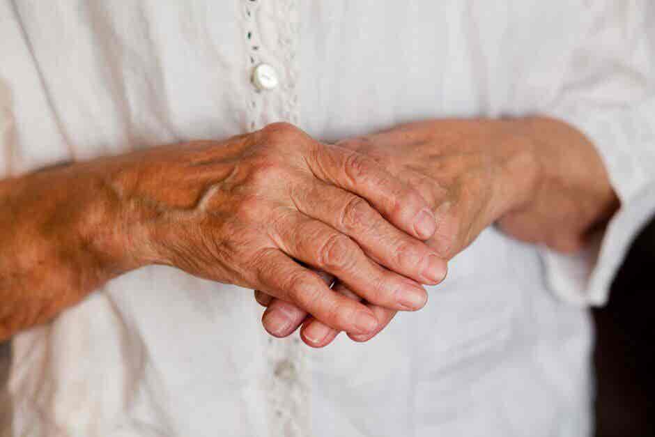 Artritis en las manos