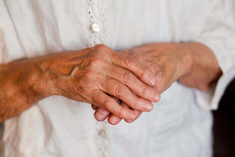 7 remedios naturales para la artritis en las manos