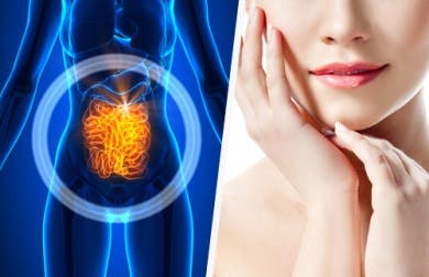 Por qué deberías sanar el intestino si quieres mejorar la piel