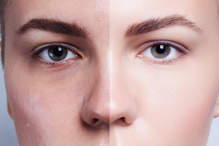 ¿Combinación natural que puede ayudar a retrasar el envejecimiento?