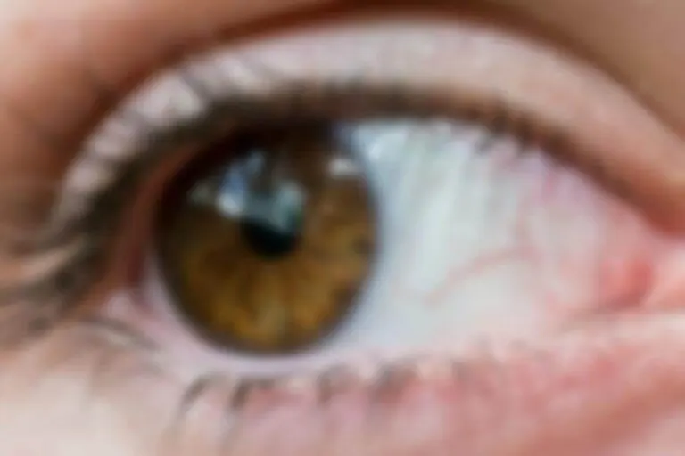 ¿A qué se debe la visión borrosa y cómo tratarla?