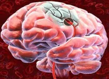 5 formas de favorecer el flujo sanguíneo cerebral