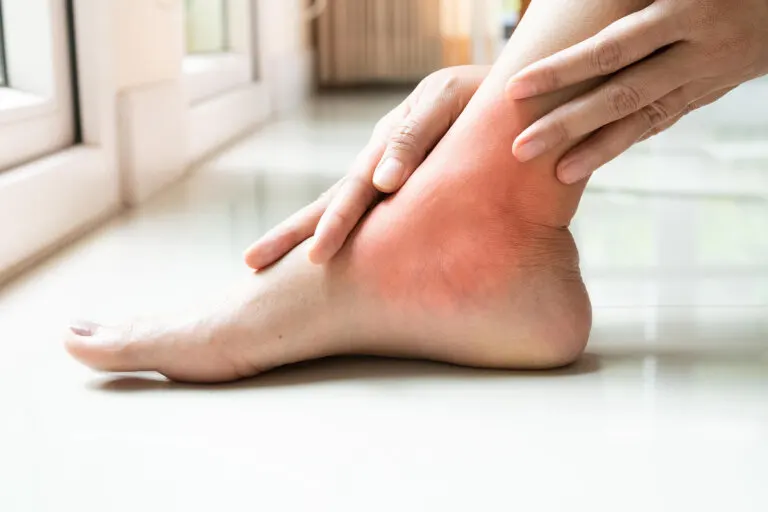 5 soluciones rápidas y naturales para desinflamar
