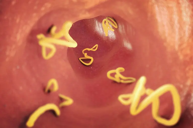 Cómo tratar las lombrices intestinales