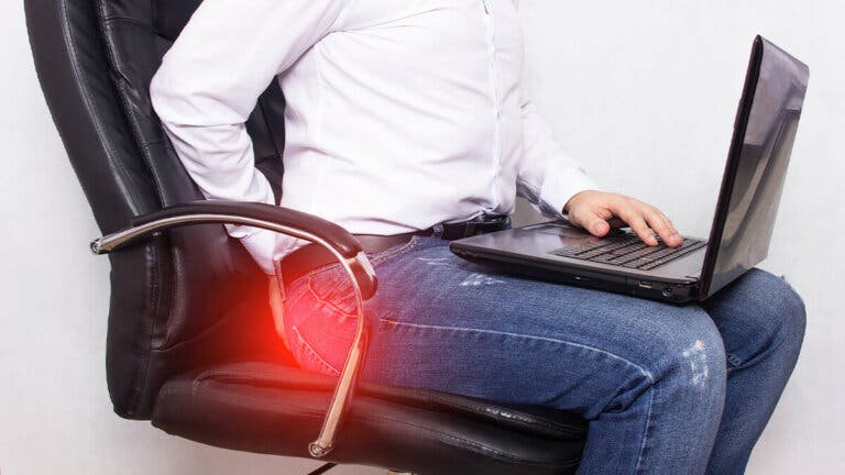Cómo tratar las hemorroides de forma natural