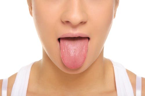 La placa bacteriana puede ser una de las causas del mal aliento.