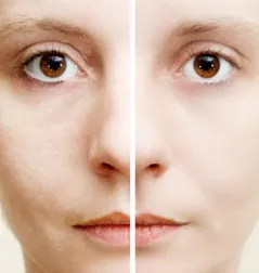 5 ingredientes naturales que ayudan a eliminar las manchas oscuras