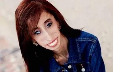 Lizzie Velásquez, una mujer bellísima