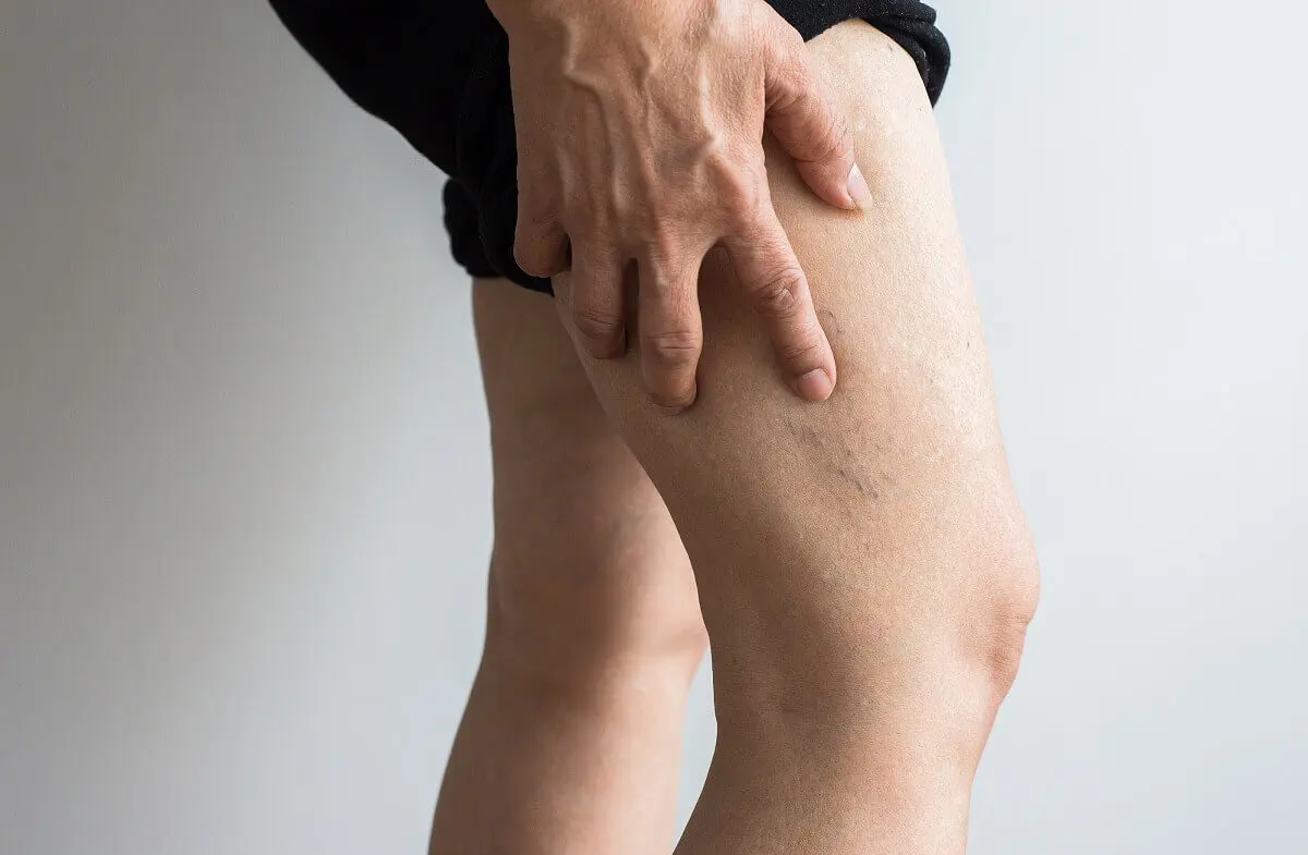 Efectos de la sal en la salud de los riñones y cómo depurarlos