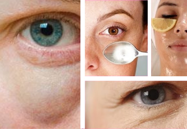 ¡No más bolsas bajo los ojos! Sencillos tips para combatirla
