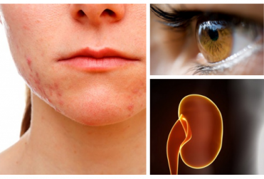 ¿Cuáles son los órganos dañados cuando sufres demasiado estrés?