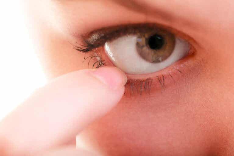 10 remedios naturales para la picazón en los ojos