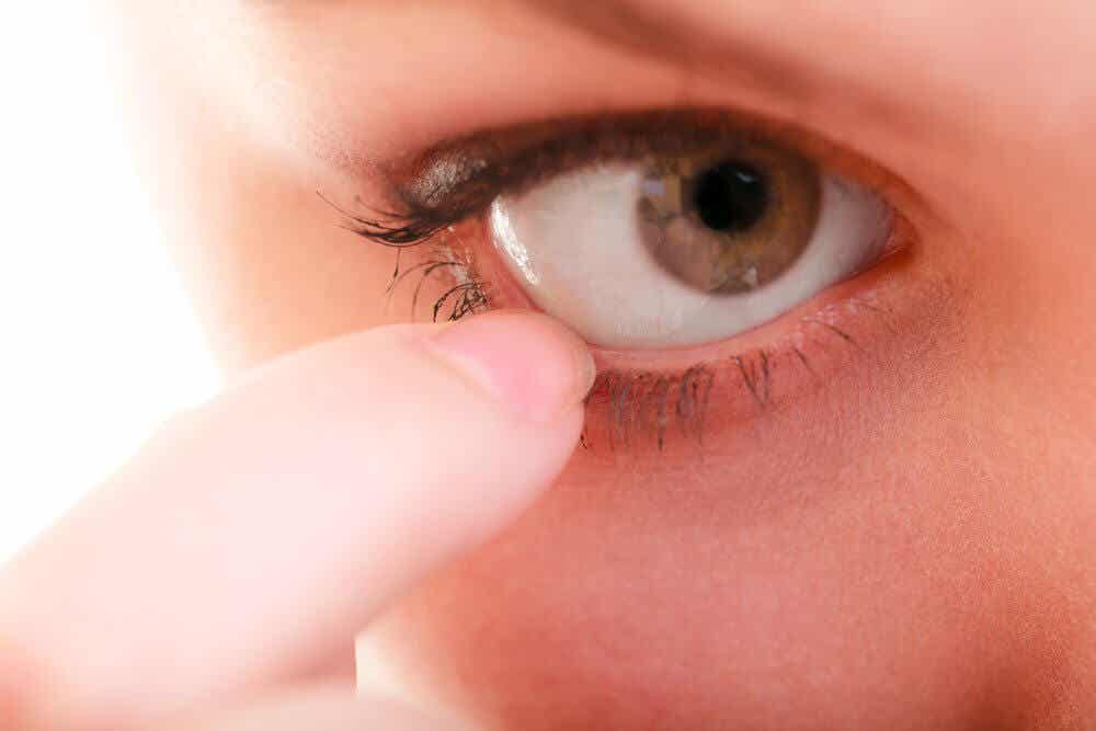 glaucoma y ojos