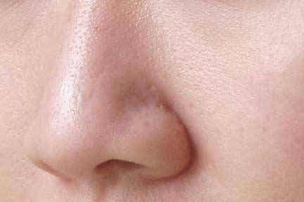 ¿Es posible cerrar los poros de forma natural?