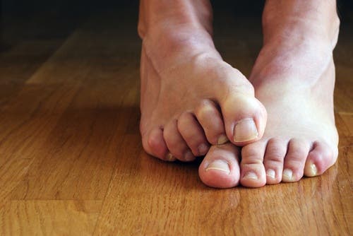 Un pie sobre otro mostrando las uñas