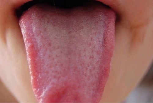 Desinfectar-la-lengua