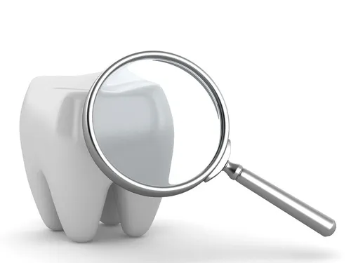 signos dentales: Dientes desgastados y planos