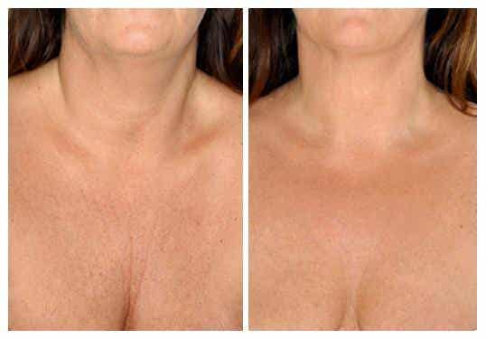 Los mejores tratamientos naturales para cuidar la piel del cuello