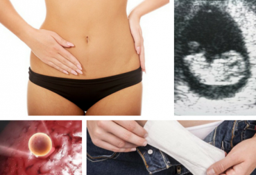 ¿Por qué se dan dos períodos menstruales en un mes?