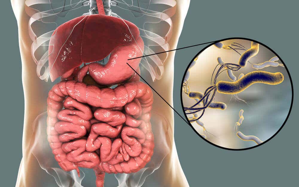 La Helicobacter pylori es la bacteria que puede atacar el estómago.