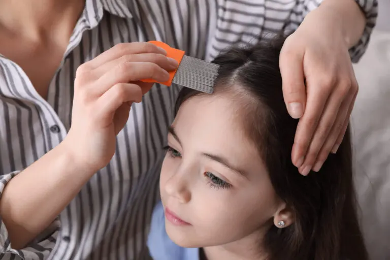 7 remedios naturales para eliminar los piojos y liendres