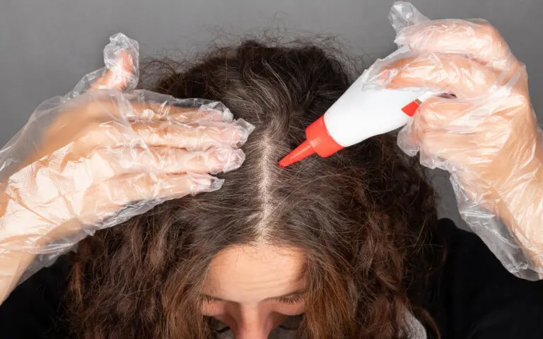 8 remedios naturales que puedes hacer con agua oxigenada