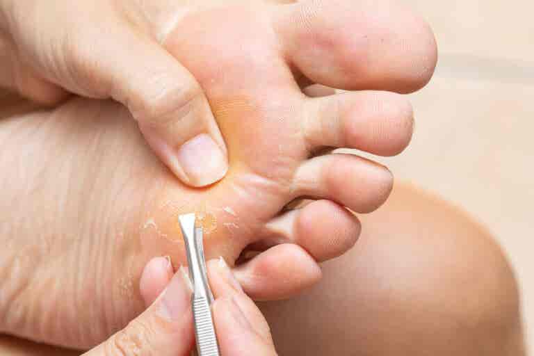 Lesiones y enfermedades de los dedos de los pies