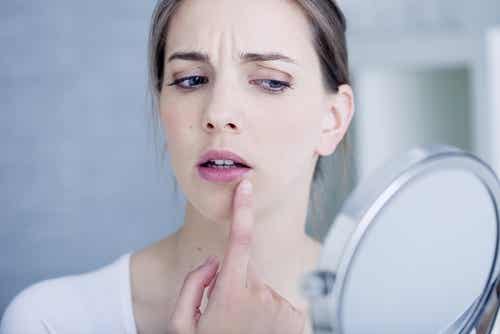 signos dentales: Úlceras o llagas bucales