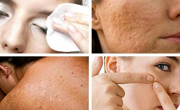 7 hábitos que perjudican la salud de tu piel y que puedes evitar